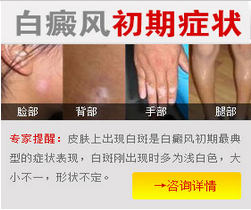 白癜风早期能治愈吗?
